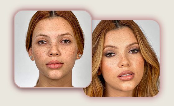Antes e depois: pele com sarda